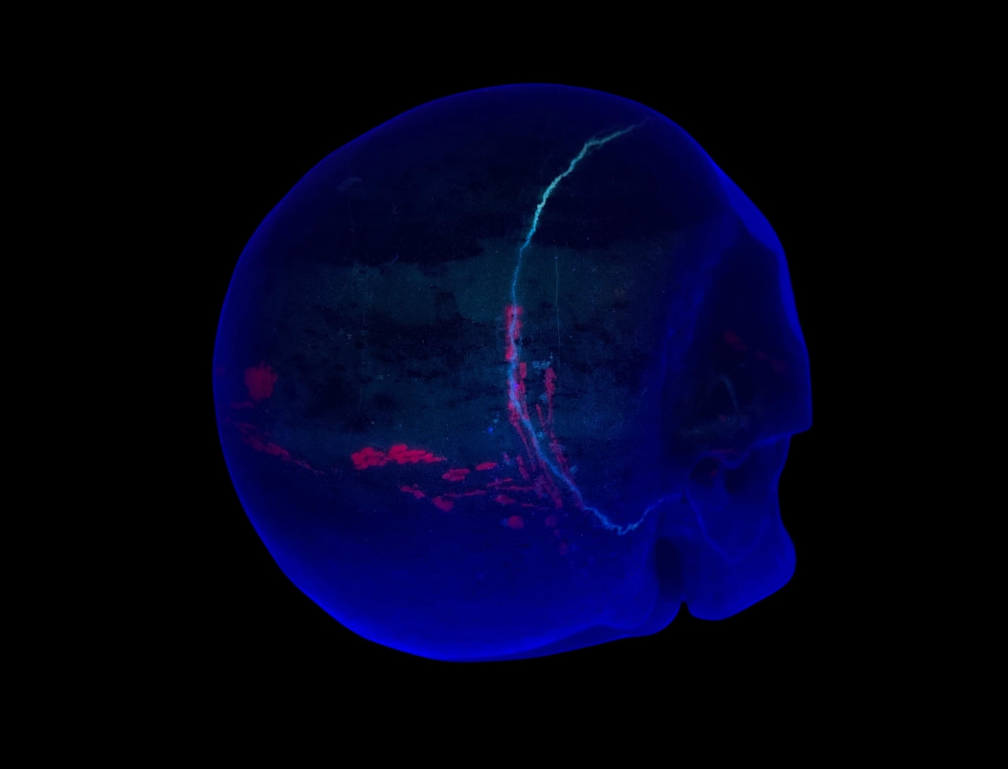 5.3" Ruby Zoisite Skull